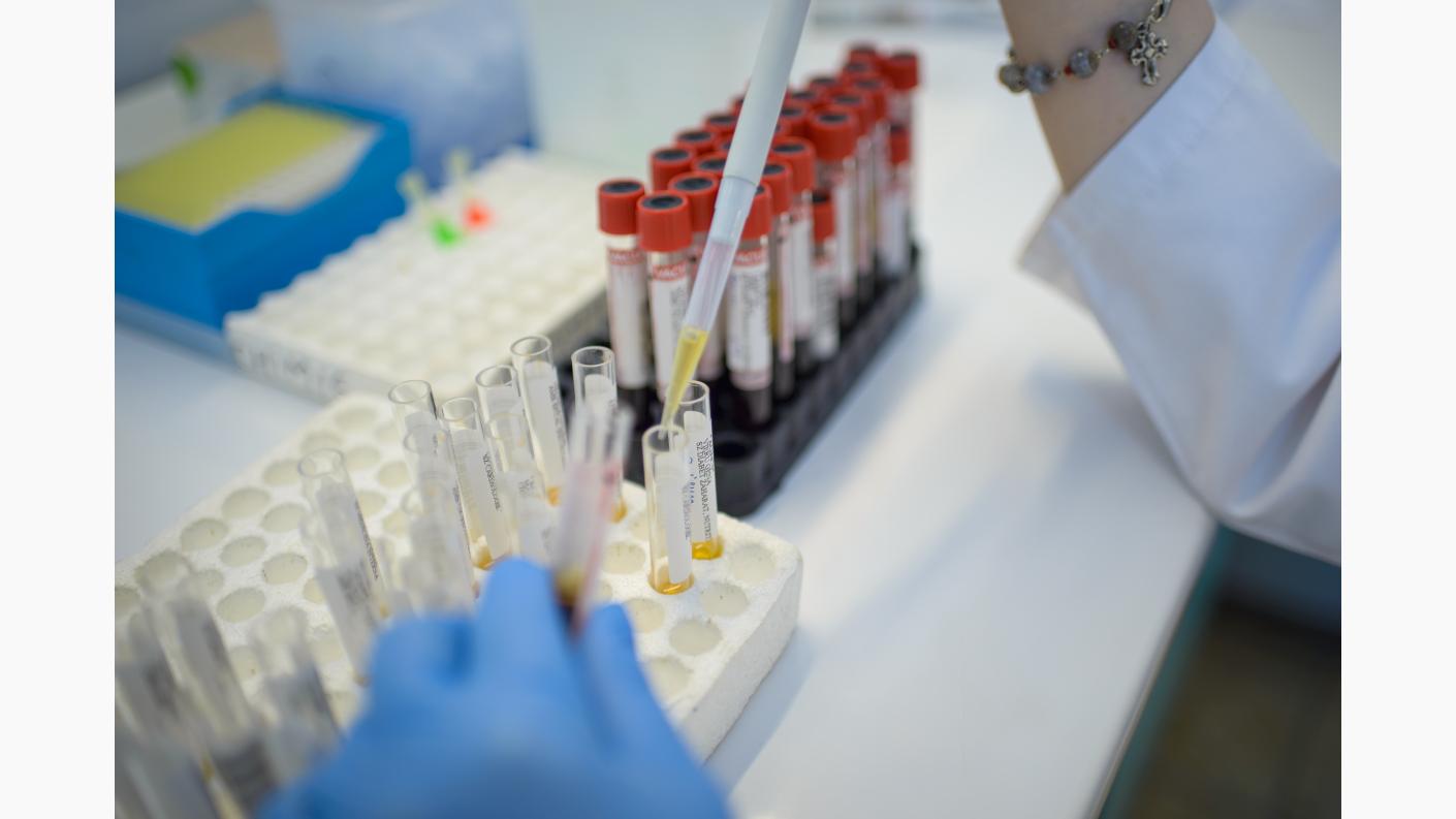 Ldl Colesterol Providența Policlinică și Spital