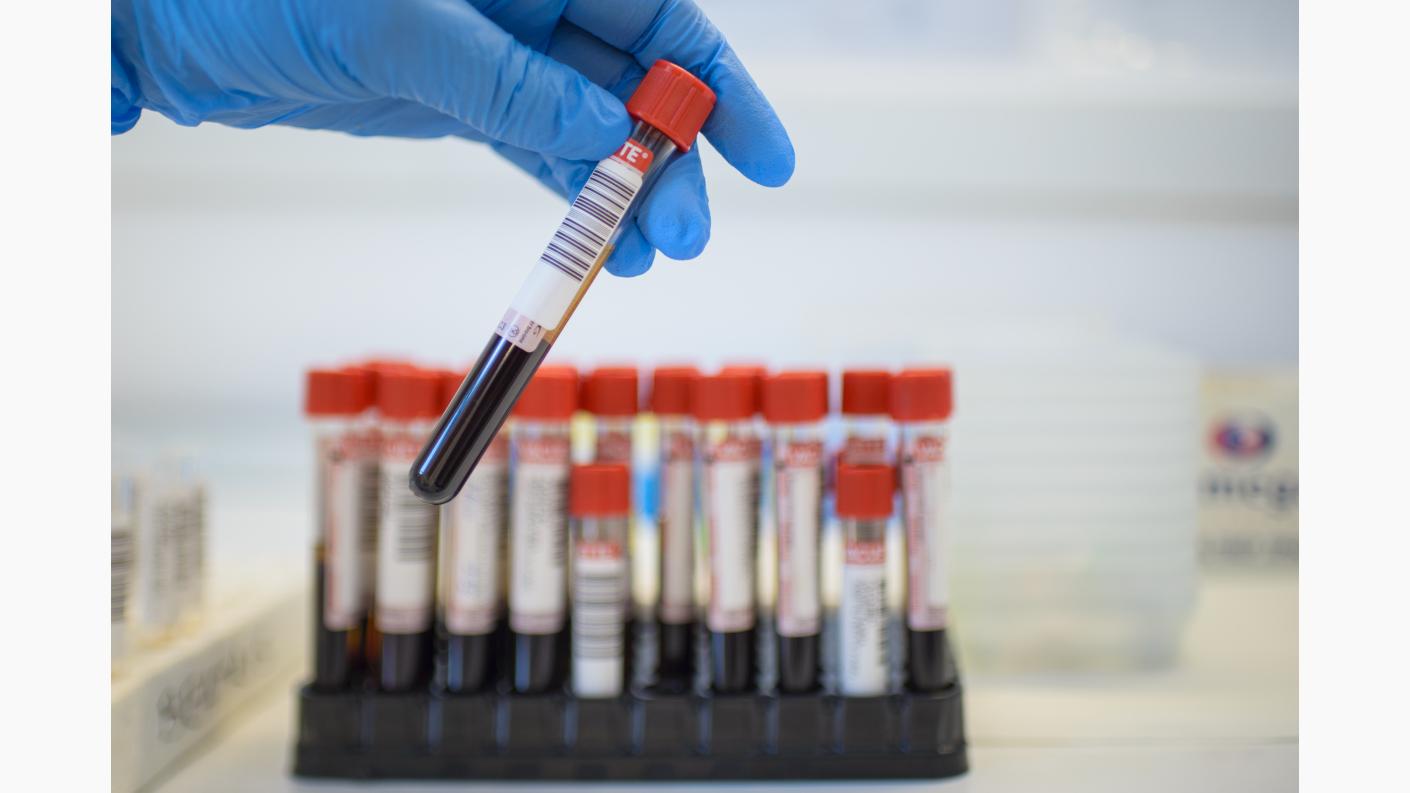 Ag Hbs Cantitativ Elfa Providența Policlinică și Spital
