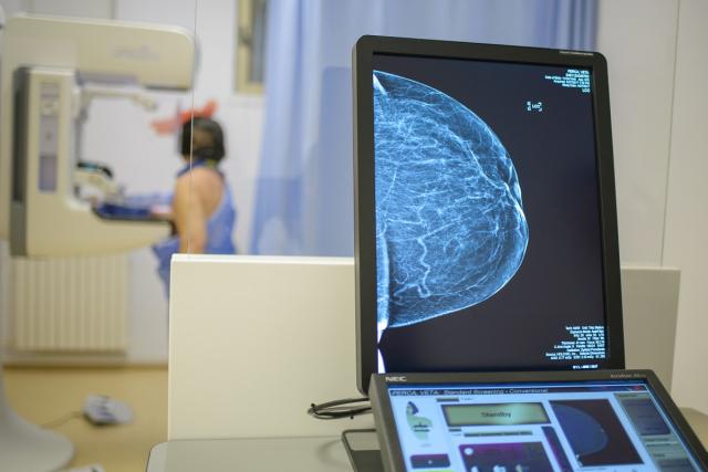 Mamografia cu tomosinteză la Spitalul Providența