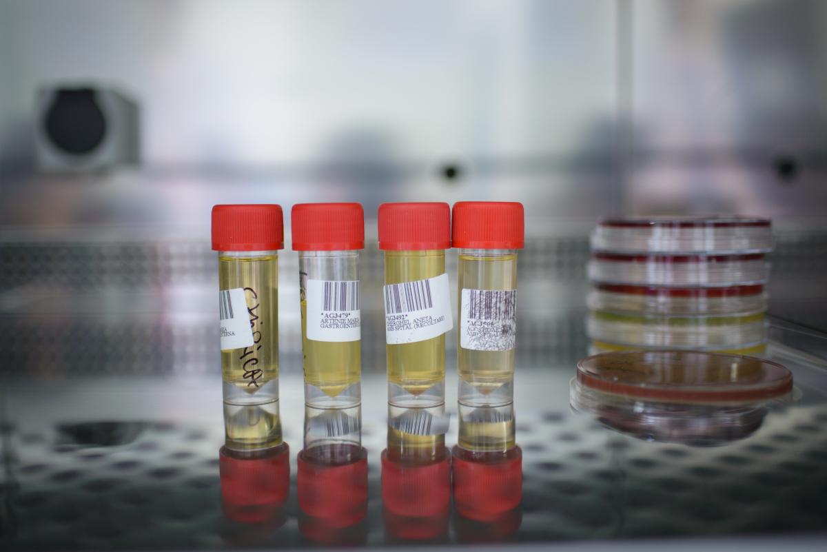 Examen Complet De Urină Sumar Sediment Providența Policlinică și Spital